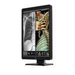 Eizo RadiForce RX660 (RX660-BK) 30″ 6MP Color Diagnostic Monitor ...