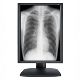 3MP Optik View 21.3 inch Grayscale Medical Grade LCD with 5 year warranty - DM21310
