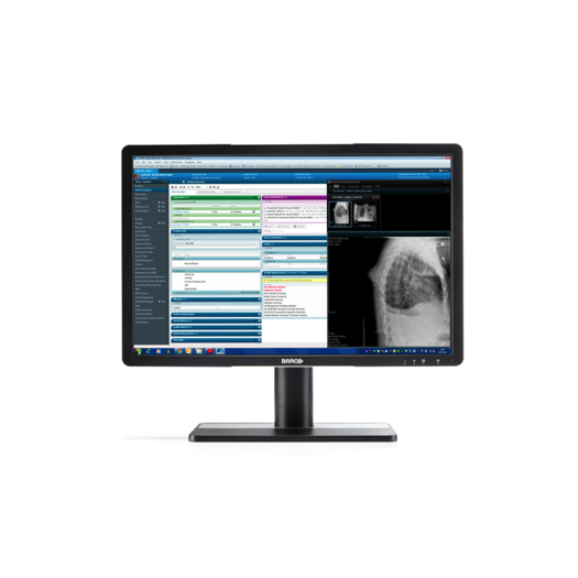 2MP Medical Clinical Eonis 24.1'' - MDRC-2224 / K9301808A