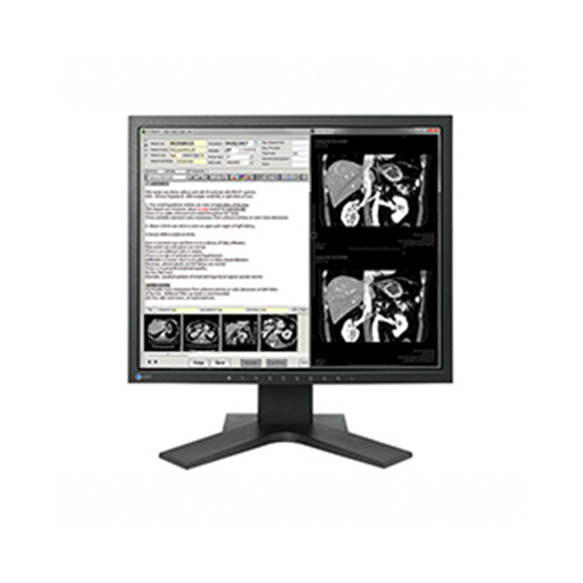 NEW! EIZO 1MP Color Monitor MX194-BK - MX194-BK