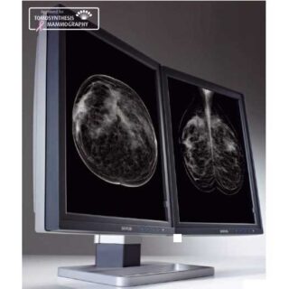 5 MP Barco Display System for Digital Breast Imaging - MDMG-5221 / K9602004