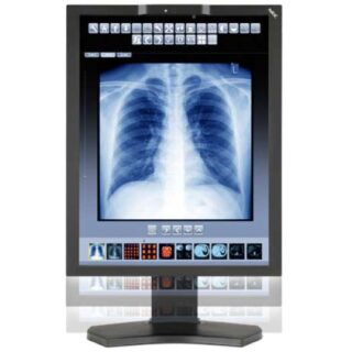 3MP NEC Diagnostic Color Display with Human Sensor - MD211C3