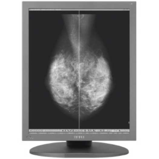 Single Head 5MP JVC/Totoku 21.3 Mammo Display - MS55i2-SH-K2000DT