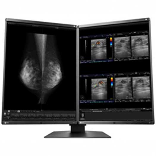 5MP EIZO RadiForce RX560-DH-NM200 Color and Monochrome Mammo Monitor - RX560-DH-NM200