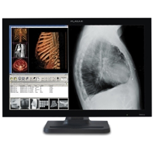 Single Head 4MP Dome E4c Color with Matrox Card & Standard Glass