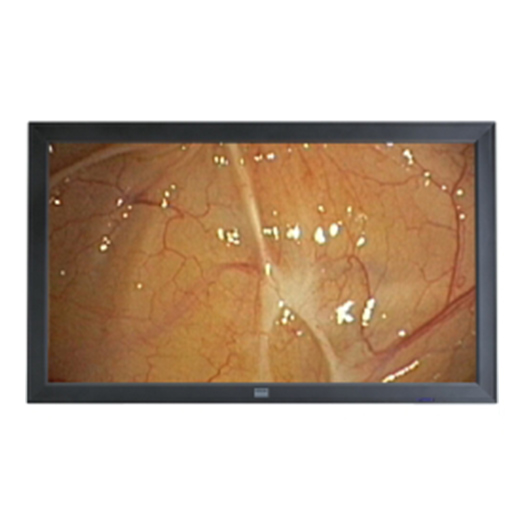 Barco 47 Inch Operating Room Display - HD-47