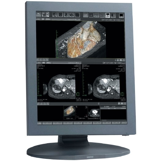 1.3MP Totoku Medical Color Monitor 18.1 - CCL182/r