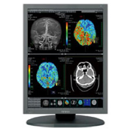 2MP Totoku 21.3” Color Display Medical Displays for Less Radiology