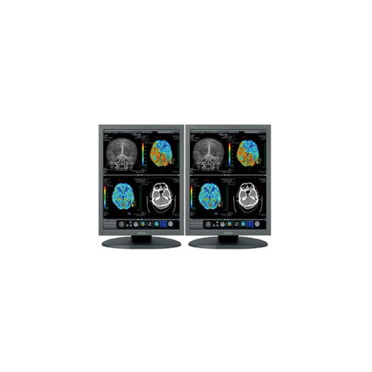 Dual Head 2MP Totoku 21.3'' Color - DH38-CCL256i2