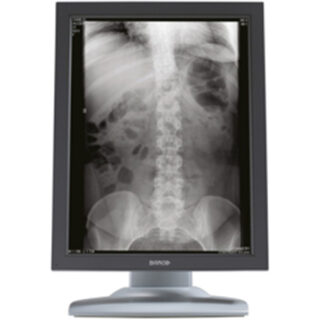 3MP Barco Nio Grayscale Display OPEN BOX SALE!