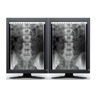 Dual Head 2MP EIZO Radiforce Monochrome - GS220-CL-DH-N200D5DE
