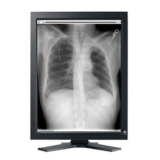 3MP EIZO RadiForce Display GS310
