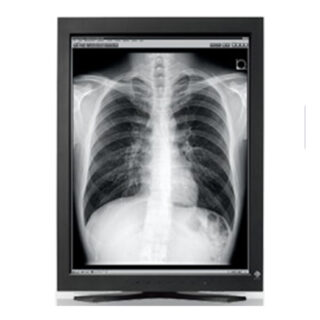 3MP EIZO 21.3'' Radiforce Monochrome Display