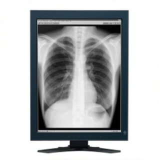 Dual Head 3MP EIZO Monochrome LCD built-in Swing Sensor & 5 Yr Warranty
