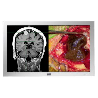 Barco 42'' High Definition LCD Display for the Operating Room - MD-4221 / K9303000A