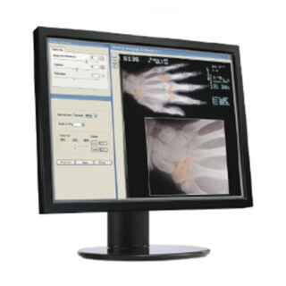 6MP BARCO Wide-screen Diagnostic Medical Color Monitor / Display System