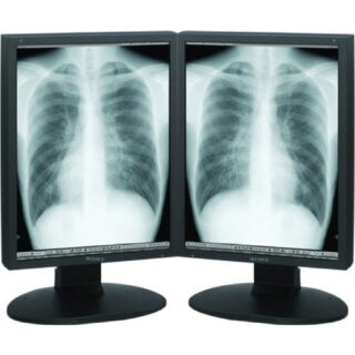 Dual Head 2MP SONY Monochrome Displayw/ Hot Swap - LMD-DM20-DH-Quadro 600