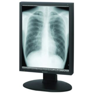 Single Head 2MP SONY Monochrome Display - LMD-DM20-SH-Quadro 600