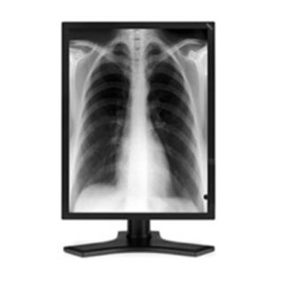 3MP NEC Grayscale with 5 Yr Hot Swap Warranty