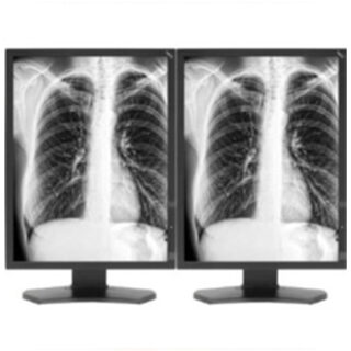 Dual Head 3MP NEC Grayscale - MD211G3-DH-NEC 2000D