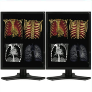 Dual Head 3MP NEC Medical Color LCD w/ 5 Year Wnty & Hot Swap