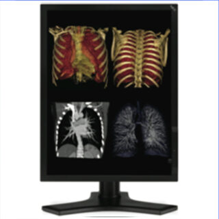 Single Head 3MP NEC Medical Color LCD w/ 5 Year Wnty & Hot Swap