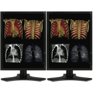 Dual Head 3MP NEC Medical Color LCD w/ 5 Year Wnty & Hot Swap - MD213MC-SH-NEC 2000D