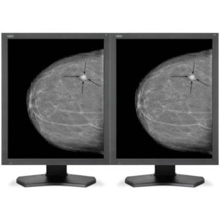 Dual Head 5MP NEC Grayscale Medical Display System - MD215MG-DH-NEC2000D