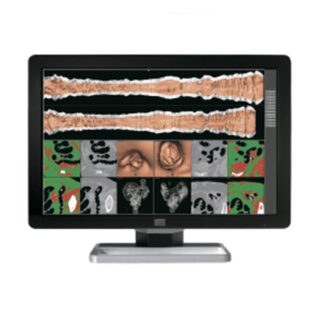 6MP BARCO Wide-screen Diagnostic Medical Color Monitor with 5200 card. HOT!