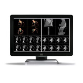 NEW! 6MP Barco Coronis LED Fusion