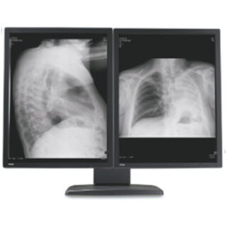 Dual Head 3MP Barco Coronis Grayscale Display - 5 Yr Warranty - Matching 5200 Card