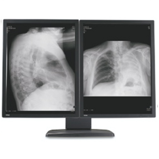 Dual Head 3MP Barco Coronis Grayscale Display - 5 Yr Warranty - Matching 5200 Card