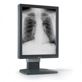 3MP NEC Medical Grayscale LCD with 5 Year Warranty & Hot Swap