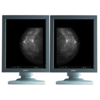 Dual Head Barco 5 MP Premium Display System for Digital Mammography