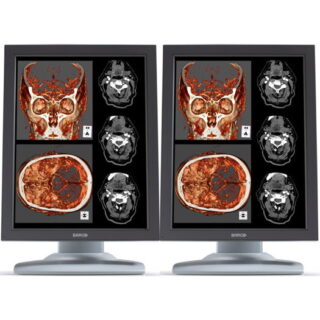 Dual Head Barco Nio Color 2MP High Bright - MDNC-2121 / K9603011