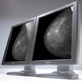 Dual Head 5MP Barco Coronis Grayscale Display System with 5 Year Warranty & 5200 Video Card - K9601007