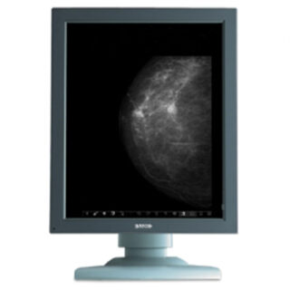 Dual Head 5MP Barco Coronis Digital Mammography System (MFGD-5621HD) with 5 Yr. Warranty
