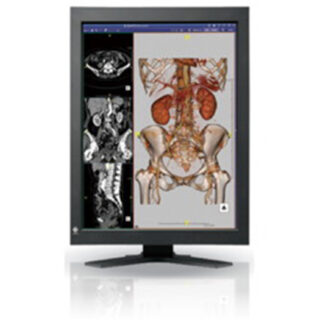 EIZO 2MP Color Display - RX220-BK-REFB