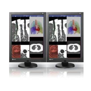 Dual Head 2MP EIZO RadiForce Color - RX240-DH-N200D5DE