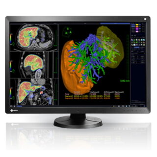6MP EIZO RadiForce 30'' Color Monitor - RX650-BK