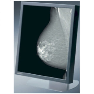 Dual Head EIZO (perviously Siemens) 5MP Blue Based, Grascale Medical LCD Display