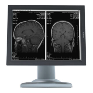 Dual Head 2MP Barco Nio Grayscale LCD Display System with NioWatch Software