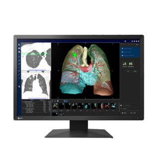 Eizo MX243W 2.3MP Clinical Review Display