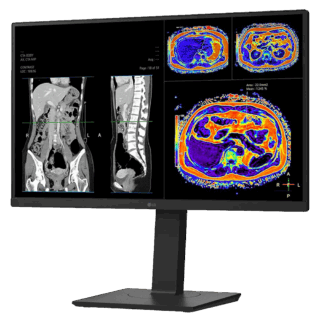 LG 27HS713C-B 27" 8MP IPS Clinical Review Monitor