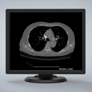 Jusha R190 1MP Monochrome Diagnostic Display