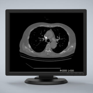 Jusha R193G 1MP Color Diagnostic Display