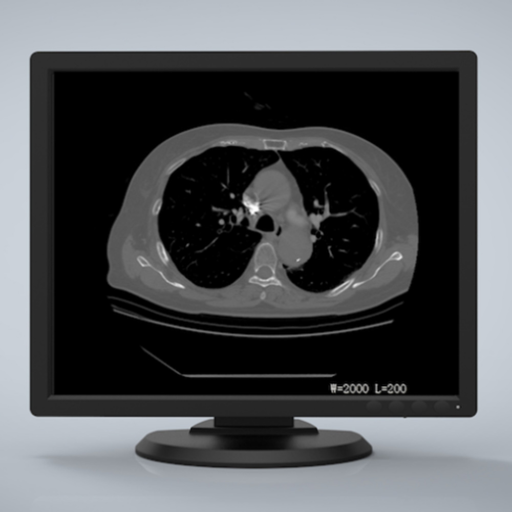 Jusha R193G 1MP Color Diagnostic Display