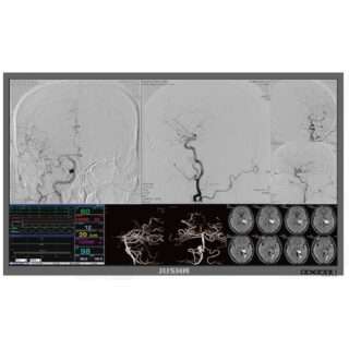 Jusha S5810 58-inch 4K Surgical Display