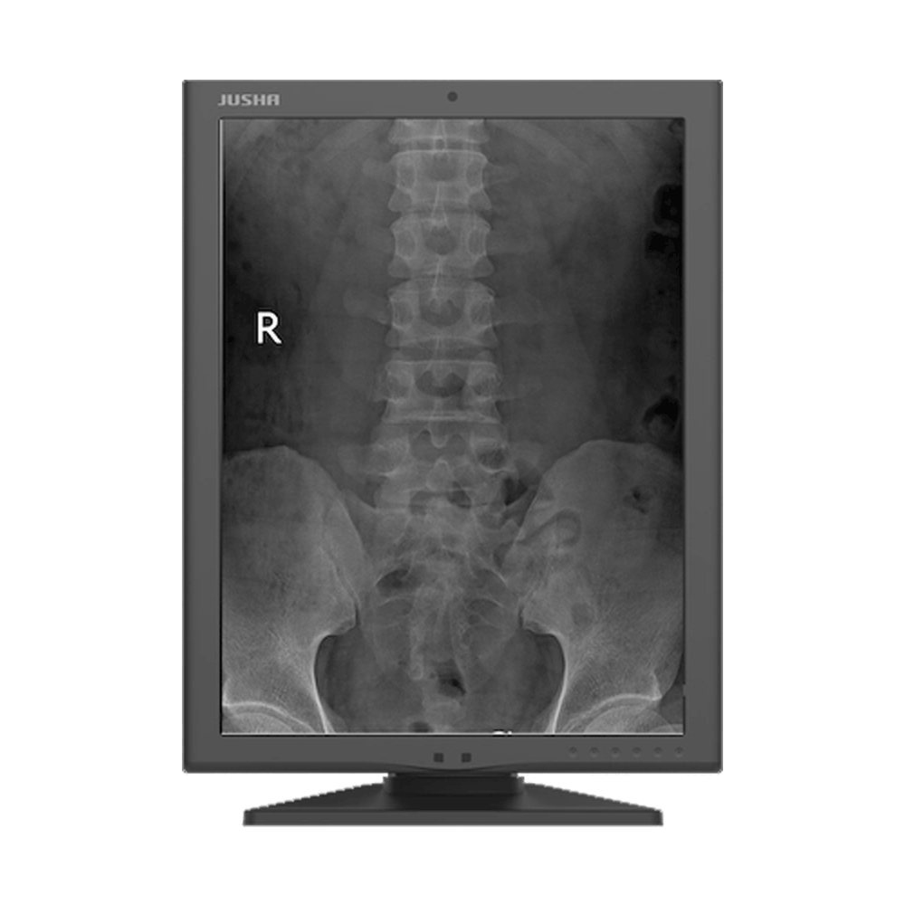 Jusha M260G 2MP Monochrome Diagnostic Display