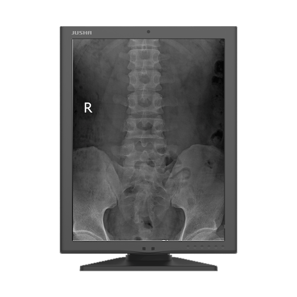 Jusha M270G 2MP Monochrome Diagnostic Display